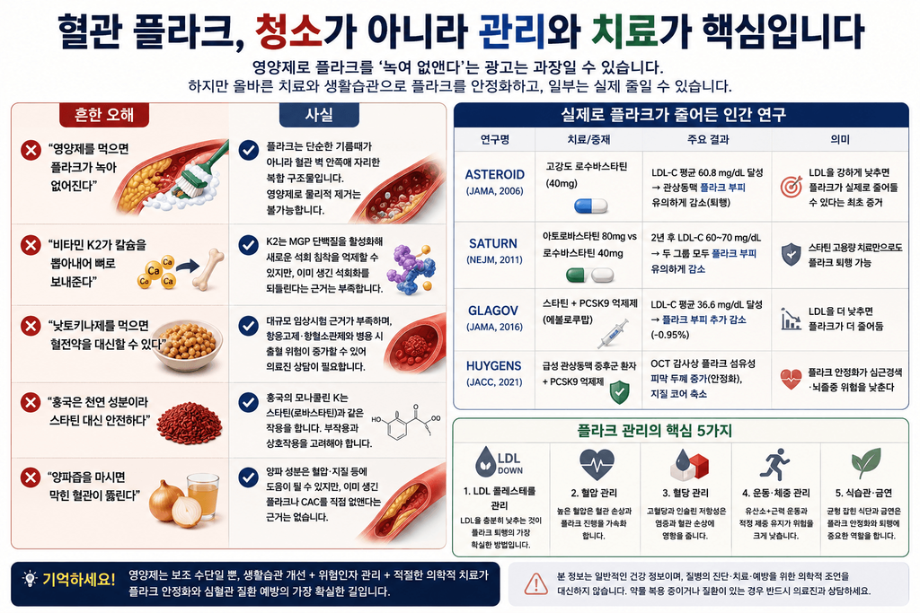 혈관 플라크 청소 오해와 실제 플라크 퇴행 연구, LDL·혈압·혈당 관리 핵심을 설명한 인포그래픽