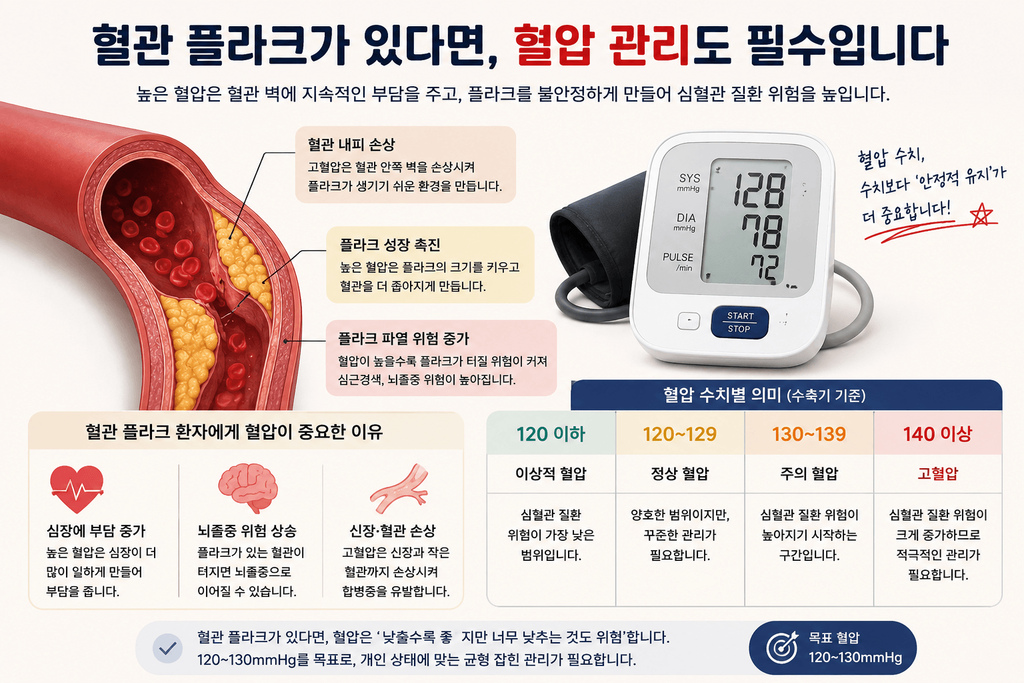 혈관 플라크 혈압 관리와 120 130 140 혈압 수치 의미