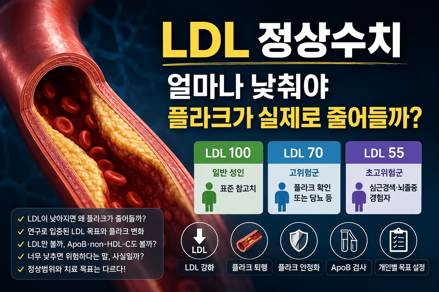 건강검진 LDL은 정상인데 왜 혈관 플라크가 생겼을까? LDL 100·70·55의 의미