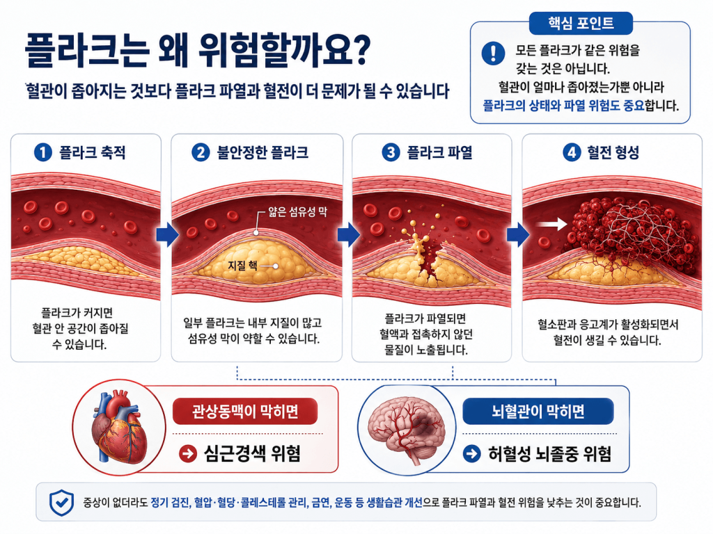 플라크는 왜 위험할까요?