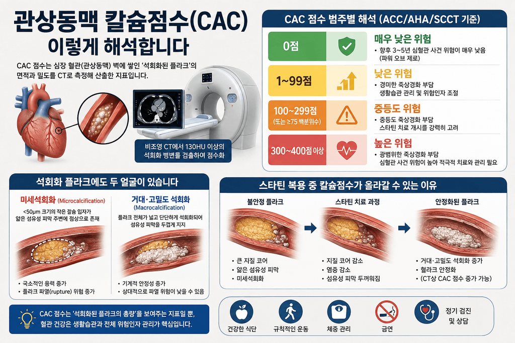 관상동맥 칼슘점수 CAC 점수별 위험도와 석회화 플라크 유형을 설명한 인포그래픽